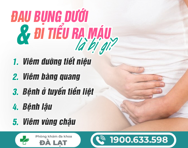 Hình ảnh minh họa
